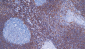 bcl-2